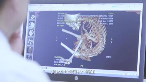 身體被敲斷4次的折疊人出院，打開折疊人生(圖6)