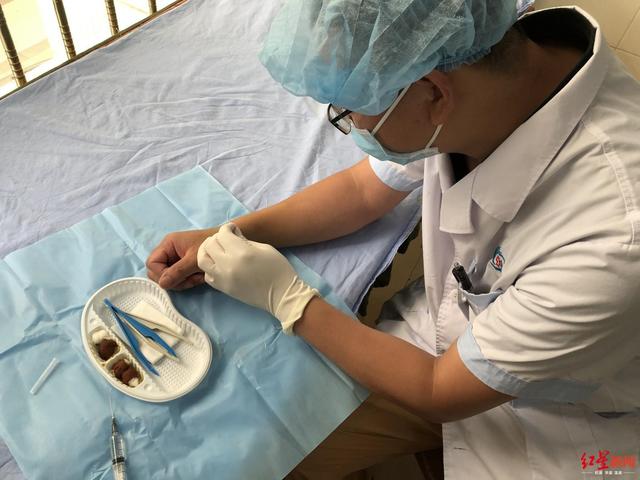 遂寧一院“狠醫(yī)生”左手給右手做手術，術后第二天就工作
