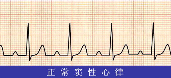 救命神器AED有多重要——你認(rèn)識它嗎？(圖6)